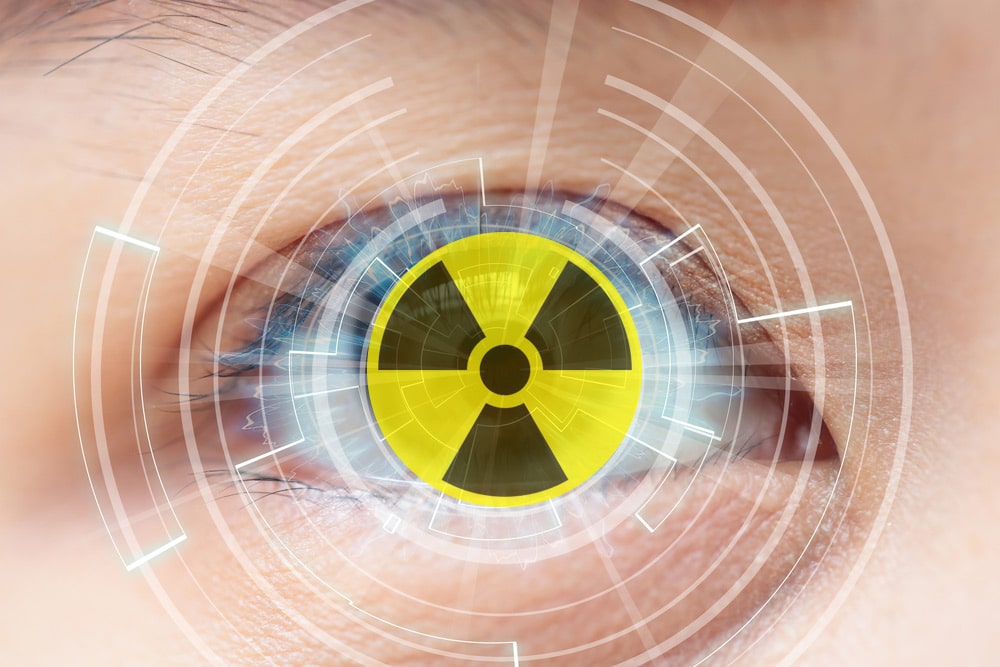 Radiation Cataractogenesis: The Progression of Our Understanding and Its Clinical Consequences